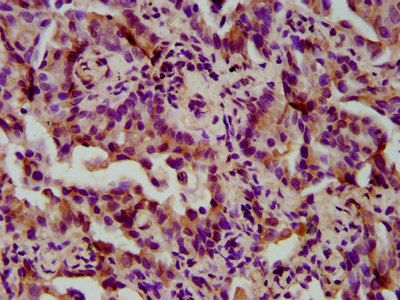 TIMELESS Antibody