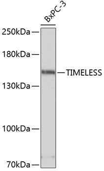 TIMELESS antibody