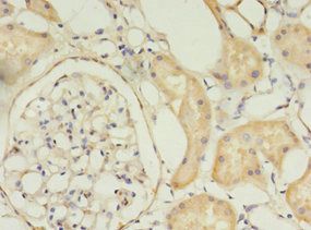 TIMM10 Antibody