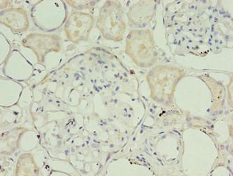 TIMM10B Antibody