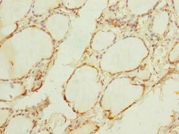 TIMM10B Antibody