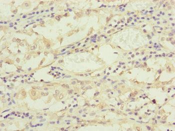 TIMM17B Antibody