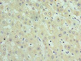 TIMM21 Antibody