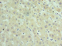 TIMM21 antibody