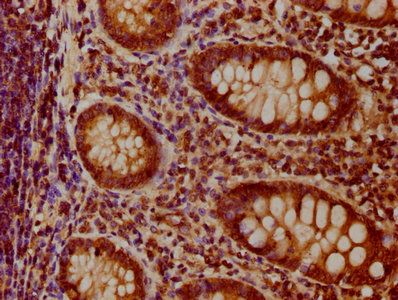 TIMMDC1 Antibody
