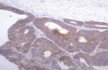 Mouse anti Human Tissue Inhibitor of Matrix Metalloproteinase 1 (TIMP-1)