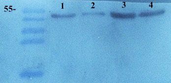 TIMP1 antibody