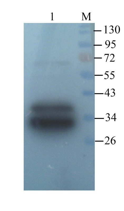 TIMP1 antibody