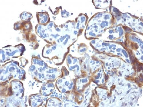 TIMP2 (Tissue Inhibitor of Metalloproteinase 2) Antibody