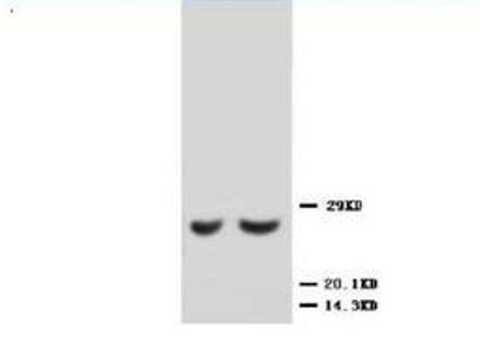 Metalloproteinase inhibitor 2 TIMP2 Antibody