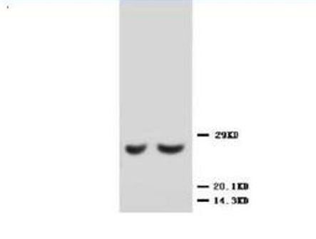 Anti-Metalloproteinase inhibitor 2 TIMP2 Antibody