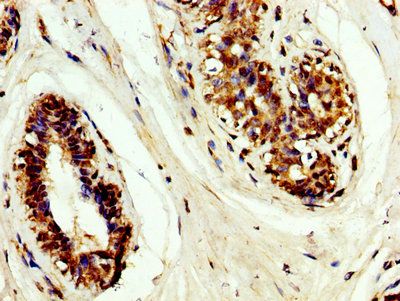 TIMP3 Antibody