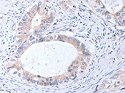 TIMP3 Antibody