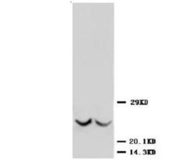 Anti-Metalloproteinase inhibitor 3 TIMP3 Antibody
