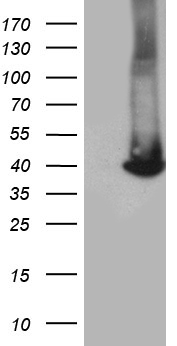 Tin2 (TINF2) antibody