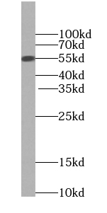 TINAG-Specific antibody