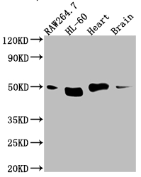 TINF2 antibody