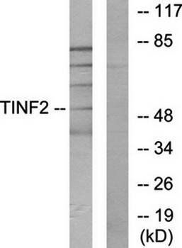 TINF2 antibody