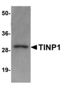 TINP1 Antibody