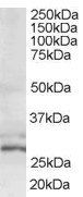 Goat anti-TIP30 / CC3 Antibody
