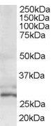 HTATIP2 antibody