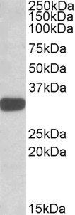 Goat anti-TIPRL Antibody