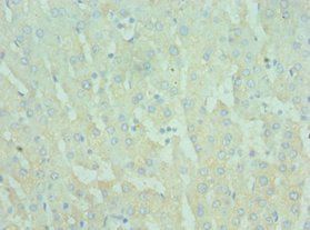 TIRAP Antibody