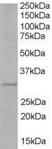 Goat anti-TIRAP / Mal (Isoform b) Antibody