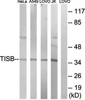 TISB antibody