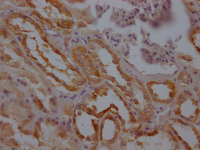 F3 Recombinant Monoclonal Antibody