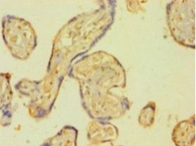 Tissue-type plasminogen activator antibody