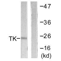 TK1 (Ab-13) antibody