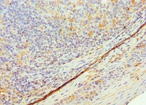 TK1 Antibody