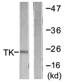 TK (Ab-13) Antibody