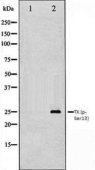 TK1 (phospho-Ser13) antibody