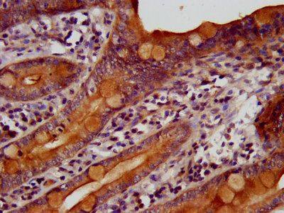 TKFC Antibody