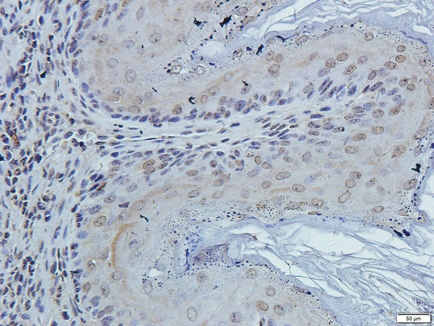 TKTL1 antibody