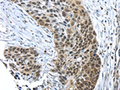 TKTL1 Antibody