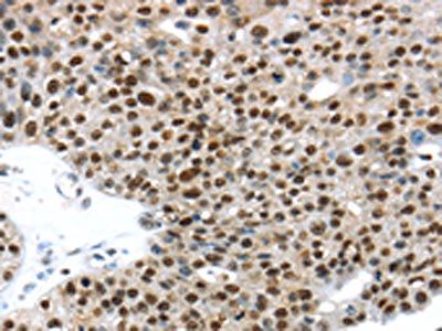 TKTL1 Antibody