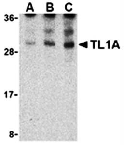 TL1A Antibody