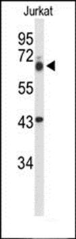 TLE1 antibody