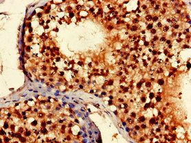 TLK2 Antibody