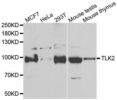TLK2 antibody