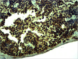 TLR1 Antibody