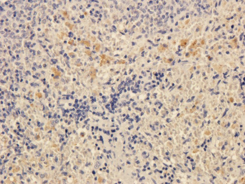 TLR2 antibody