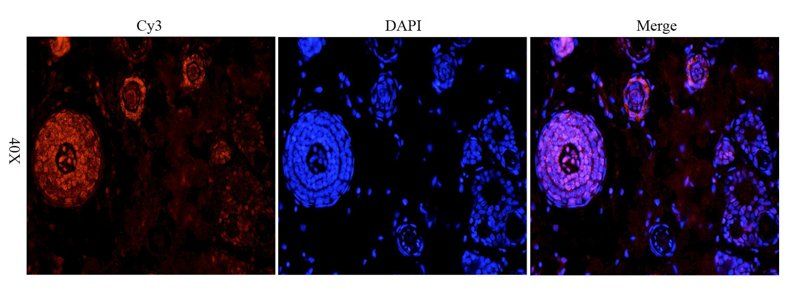 TLR2 Rabbit Polyclonal Antibody