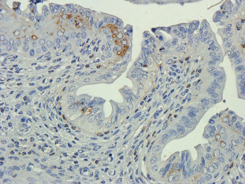 TLR2 Rabbit Polyclonal Antibody