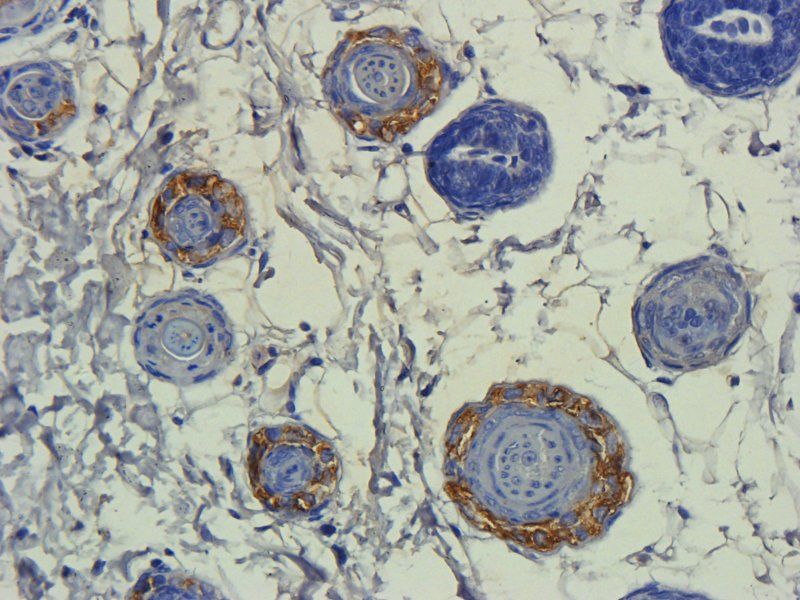 TLR2 antibody