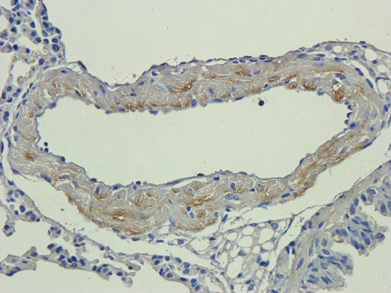 TLR2 Rabbit Polyclonal Antibody