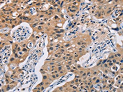 TLR3 Antibody